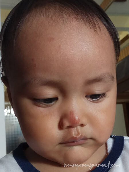 muka baret honeymoonjournal.com